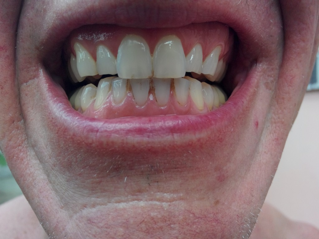 Before - yuck!