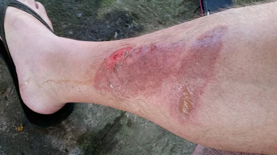 Muffler Burn 10 4 15